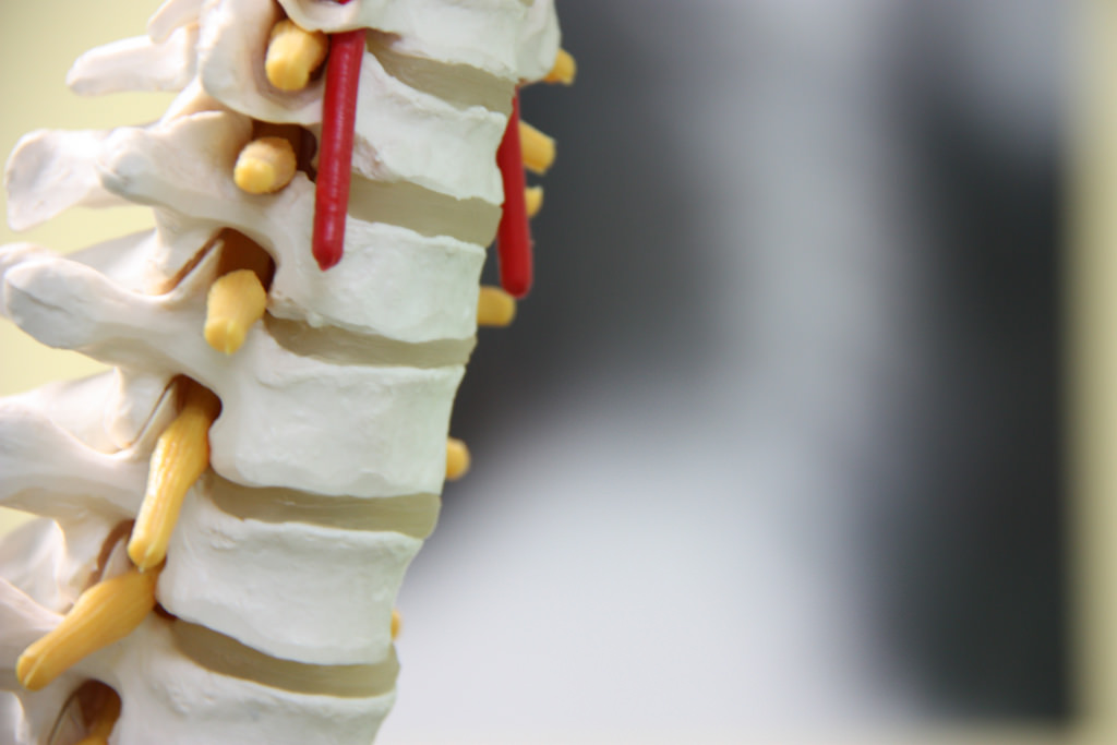 Postural Rehabilitation